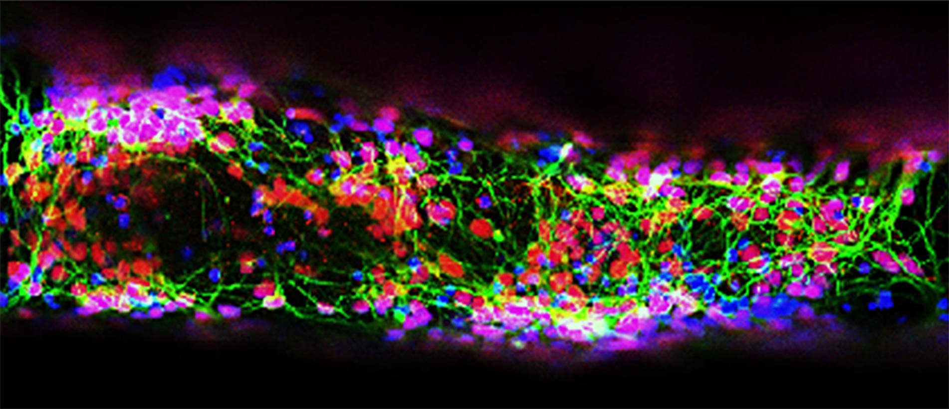 Это улучшенное изображение показывает живые клетки, которые пережили процесс 3D-печати. Нейронные стволовые клетки, полученные из взрослых человеческих клеток, были напечатаны на 3D-принтере, а после дифференцированы в активные нервные клетки в лаборатории.