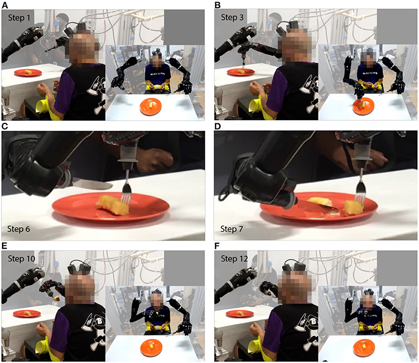 Людина з паралічем їсть страву за допомогою роботизованих рук
